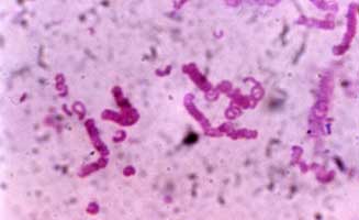 Clostridium spiroforme